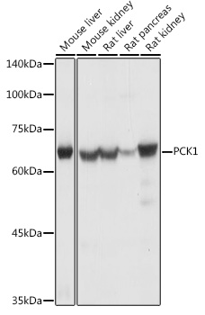 Anti-PCK1 / PEPC Antibody