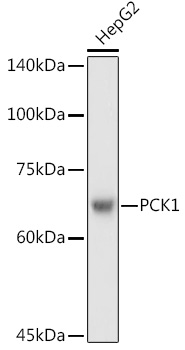 Anti-PCK1 / PEPC Antibody Anti-PCK1 / PEPC Antibody