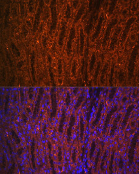 Anti-PCK1 / PEPC Antibody Anti-PCK1 / PEPC Antibody