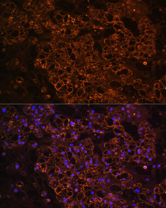 Anti-PCK1 / PEPC Antibody Anti-PCK1 / PEPC Antibody