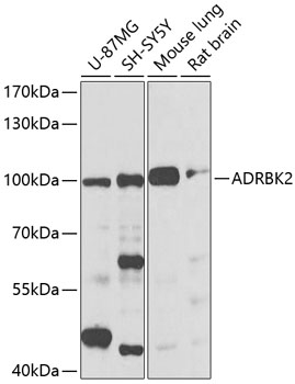 Anti-GRK3 Antibody