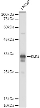 Anti-Prostate Specific Antigen Antibody