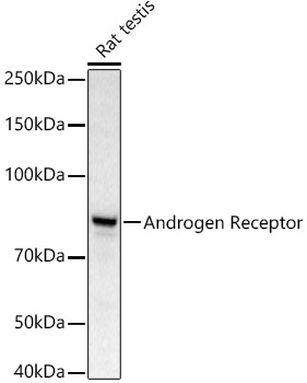 Anti-Androgen Receptor Antibody