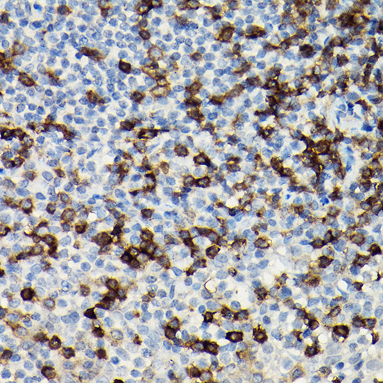 Anti-CD3 zeta Antibody Anti-CD3 zeta Antibody