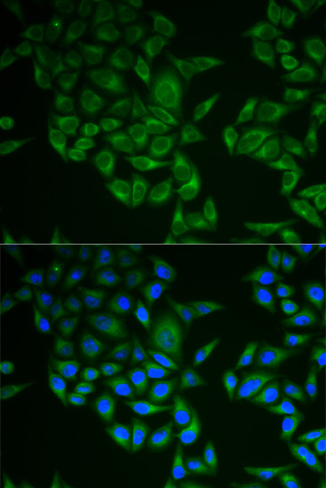 Anti-CD3 zeta Antibody Anti-CD3 zeta Antibody