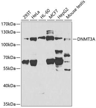 Anti-Dnmt3a Antibody
