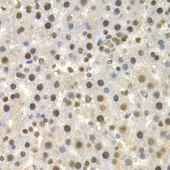 Anti-Torsin A / DYT1 Antibody Anti-Torsin A / DYT1 Antibody