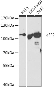 Anti-EEF2 / Elongation factor 2 Antibody
