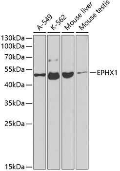 Anti-Epoxide hydrolase Antibody