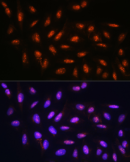 Anti-FANCD2 Antibody - Identical to Abcam (ab175382) Anti-FANCD2 Antibody - Identical to Abcam (ab175382)