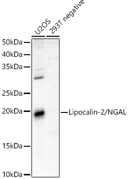 Anti-Lipocalin-2 / NGAL Antibody