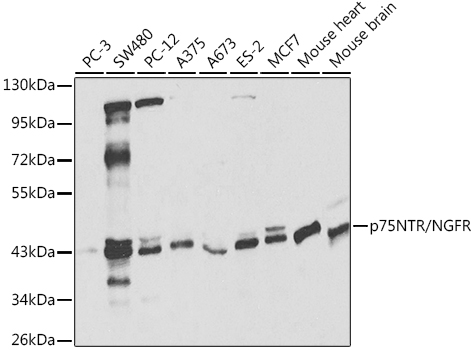 Anti-p75 NGF Receptor Antibody