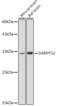 Anti-DARPP32 Antibody