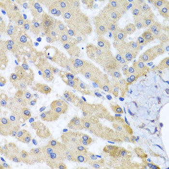 Anti-ABCB8 Antibody Anti-ABCB8 Antibody