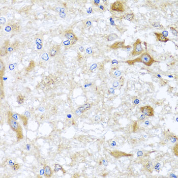 Anti-ABCB8 Antibody Anti-ABCB8 Antibody