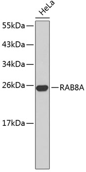 Anti-RAB8A Antibody