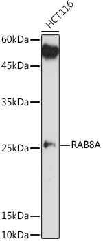 Anti-RAB8A Antibody Anti-RAB8A Antibody