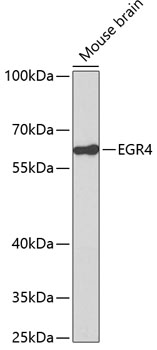 Anti-EGR4 Antibody
