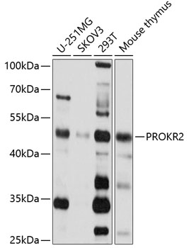 Anti-PROKR2 Antibody