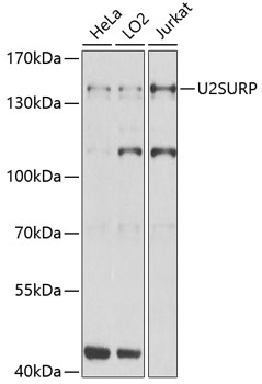 Anti-SR140 Antibody