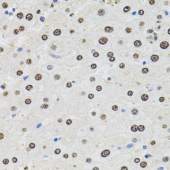 Anti-SR140 Antibody Anti-SR140 Antibody