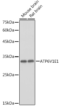 Anti-ATP6V1E1 Antibody