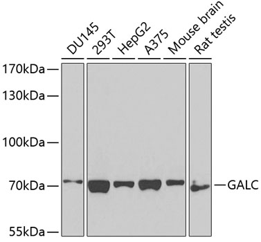 Anti-GALC Antibody