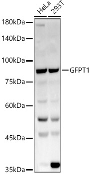 Anti-GFPT1 Antibody