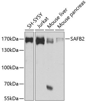 Anti-SAF-B2 Antibody
