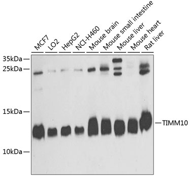 Anti-TIMM10 Antibody