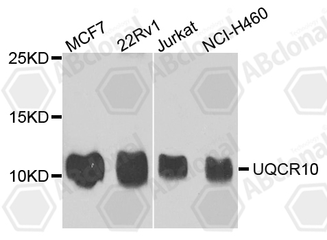 Anti-UQCR10 Antibody