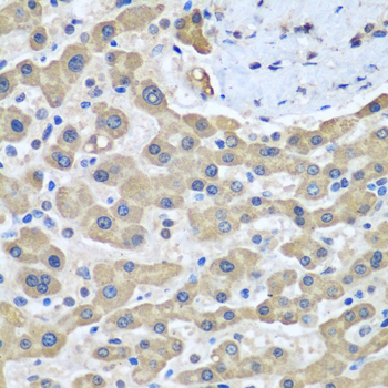 Anti-GFM1 Antibody