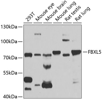 Anti-FBXL5 Antibody