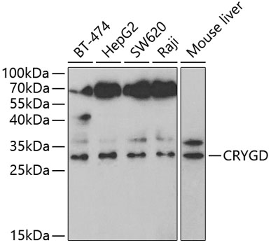 Anti-CRYGD Antibody