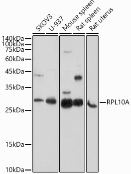 Anti-RPL10A Antibody