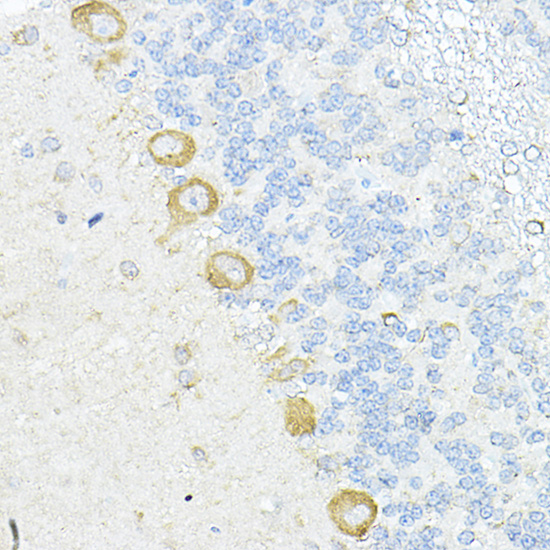 Anti-RPL10A Antibody Anti-RPL10A Antibody