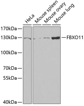 Anti-FBXO11 Antibody