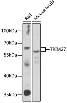 Anti-TRIM27 Antibody