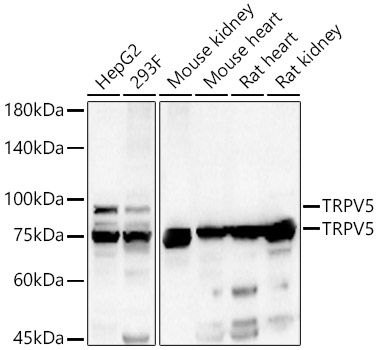Anti-TRPV5 Antibody