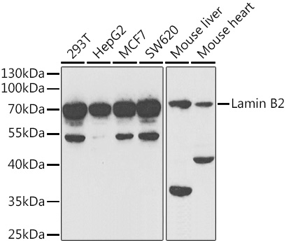 Anti-Lamin B2 Antibody
