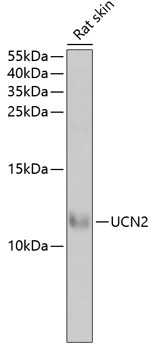 Anti-UCN2 / SRP Antibody