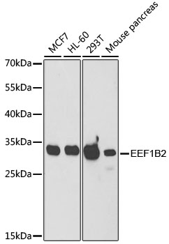 Anti-eEF1B2 Antibody