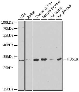 Anti-HUS1B Antibody