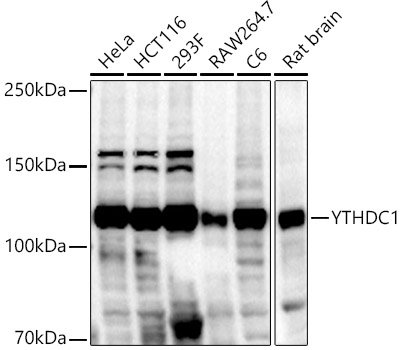 Anti-YTHDC1 Antibody