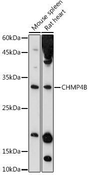 Anti-CHMP4B Antibody Anti-CHMP4B Antibody