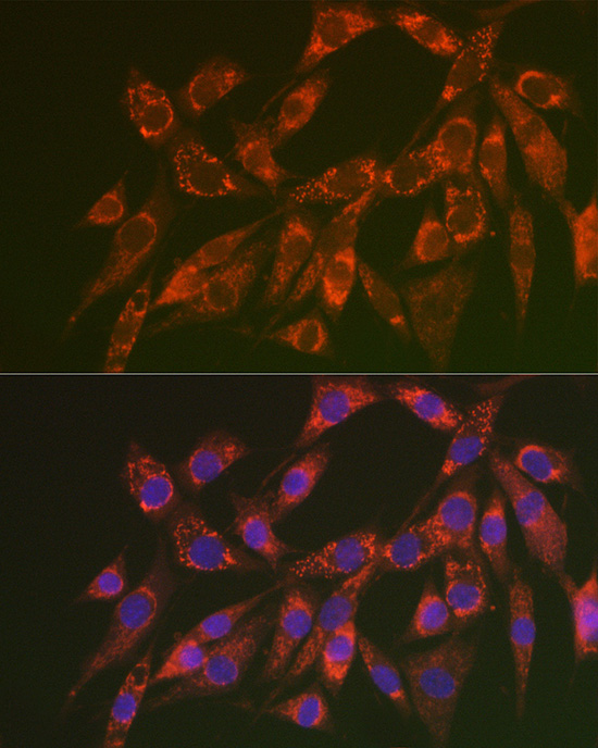 Anti-CHMP4B Antibody Anti-CHMP4B Antibody