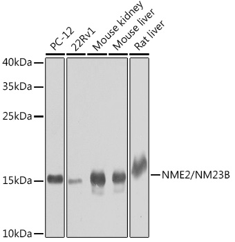 Anti-NME2 Antibody