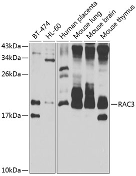 Anti-RAC3 Antibody