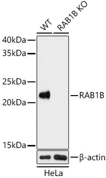 Anti-RAB1B Antibody