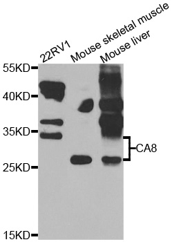 Anti-CA8 Antibody